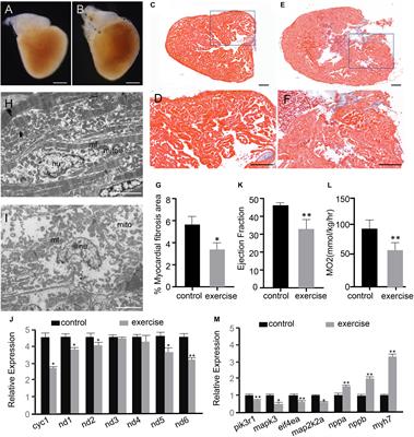 Identification of Potentially Relevant Genes for Excessive Exercise-Induced Pathological Cardiac Hypertrophy in Zebrafish
